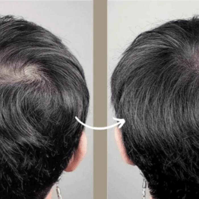 Scalp Essence For Men 60ml